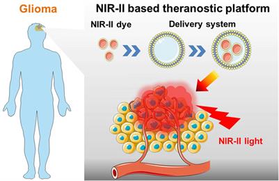 Recent advances in NIR-II fluorescence based theranostic approaches for glioma